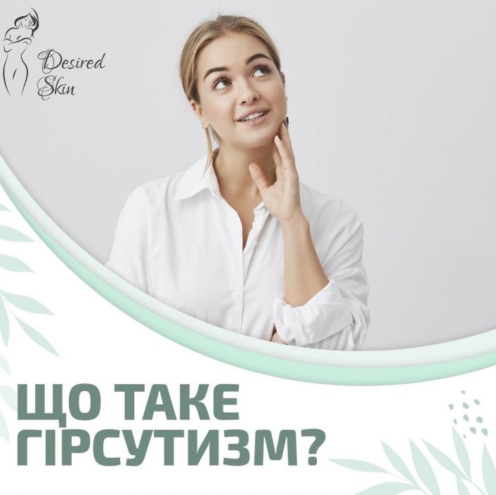 Що таке гірсутизм? image