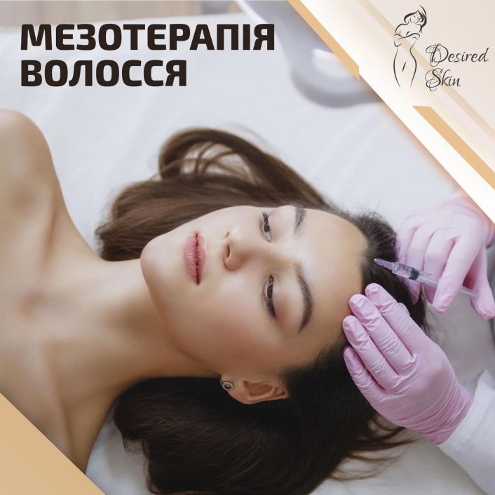 Мезотерапія волосся image